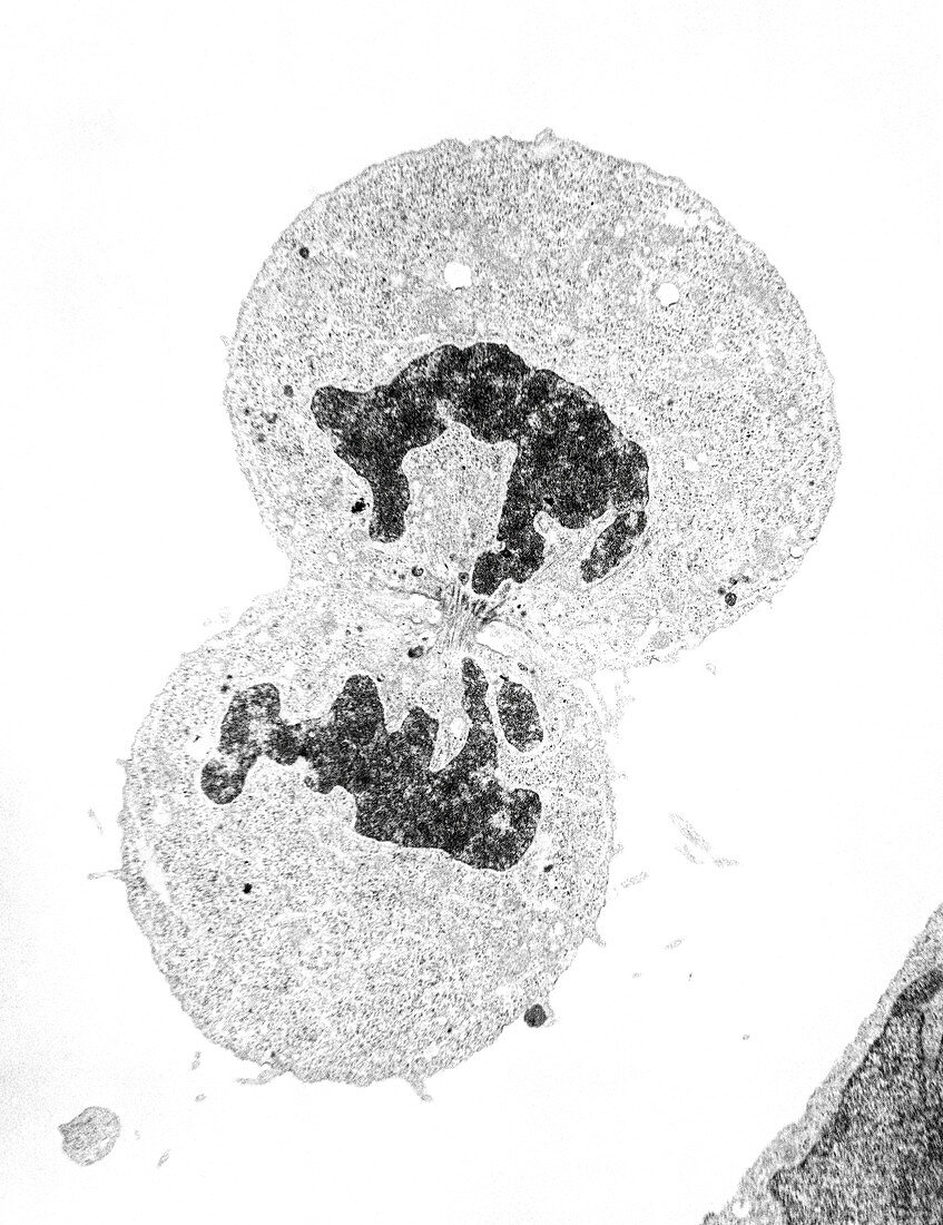 TEM of mitosis (telophase) of human kidney cell
