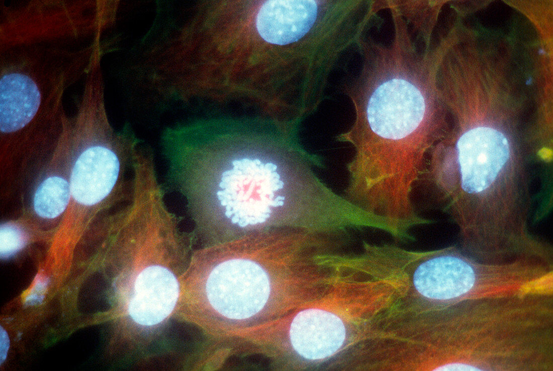 Immunofluorescent LM of dividing HeLa cancer cell