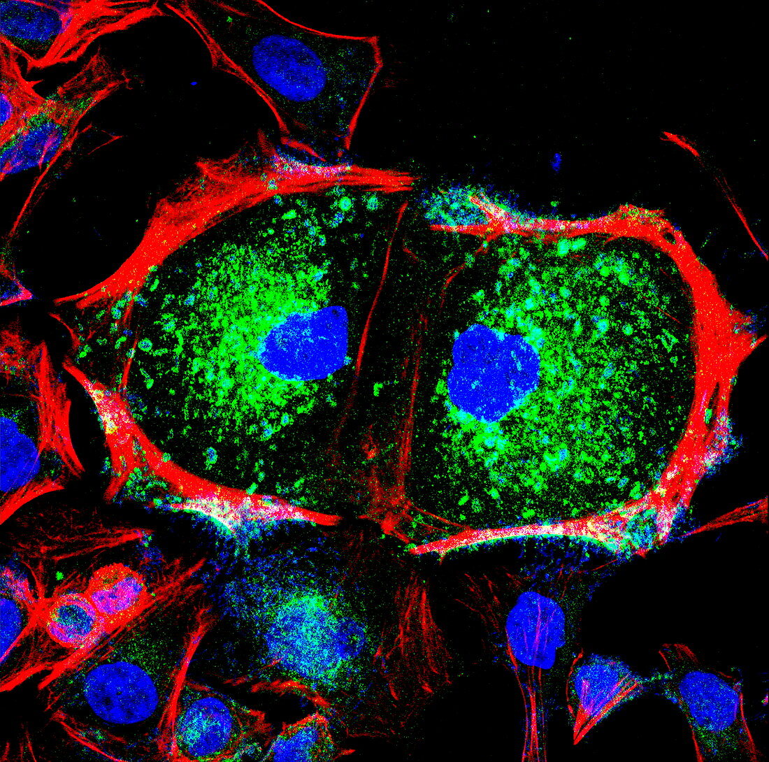 Dividing cell,light micrograph