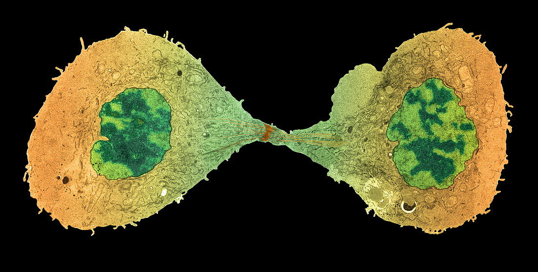 Mitotic cell division,TEM