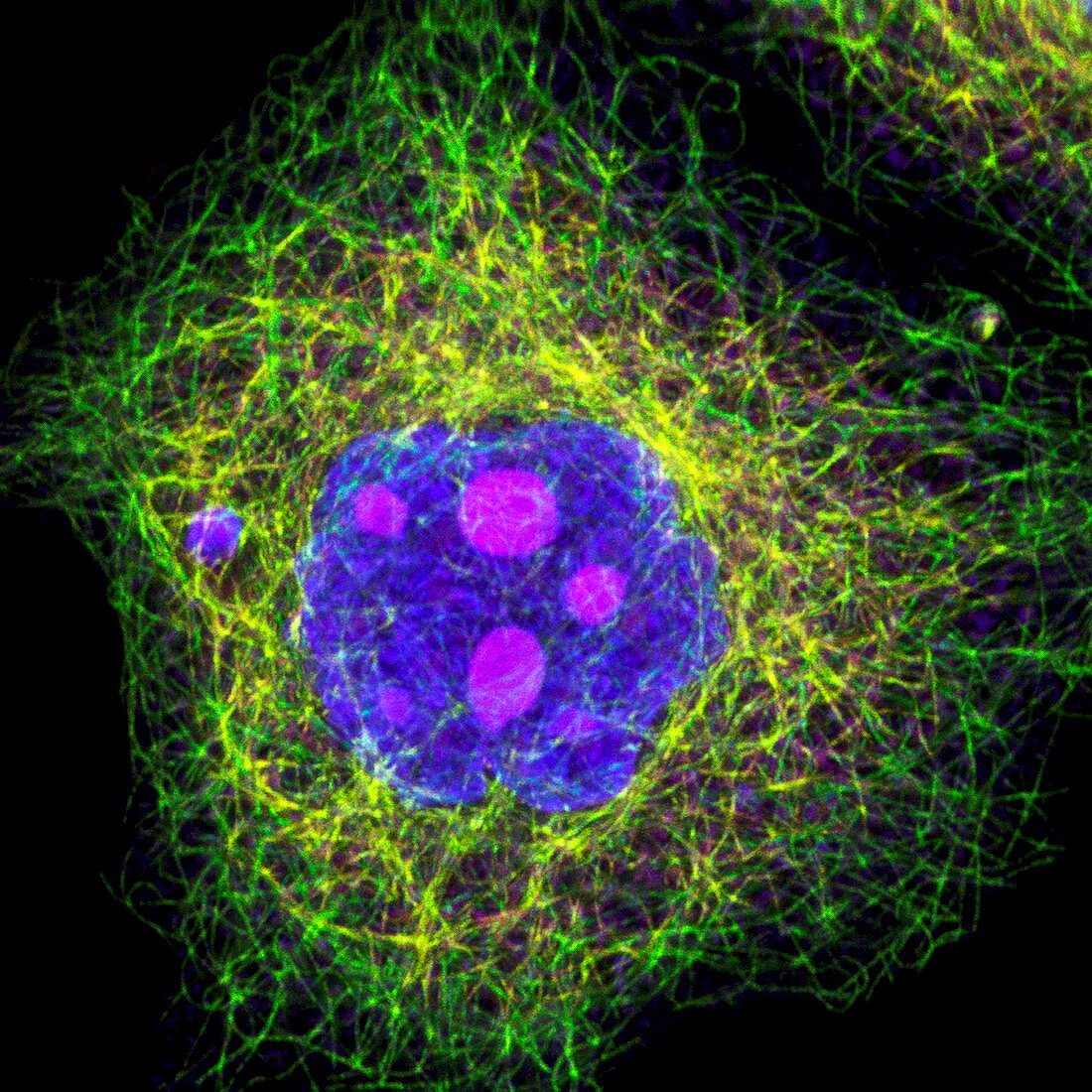 HeLa cell,light micrograph