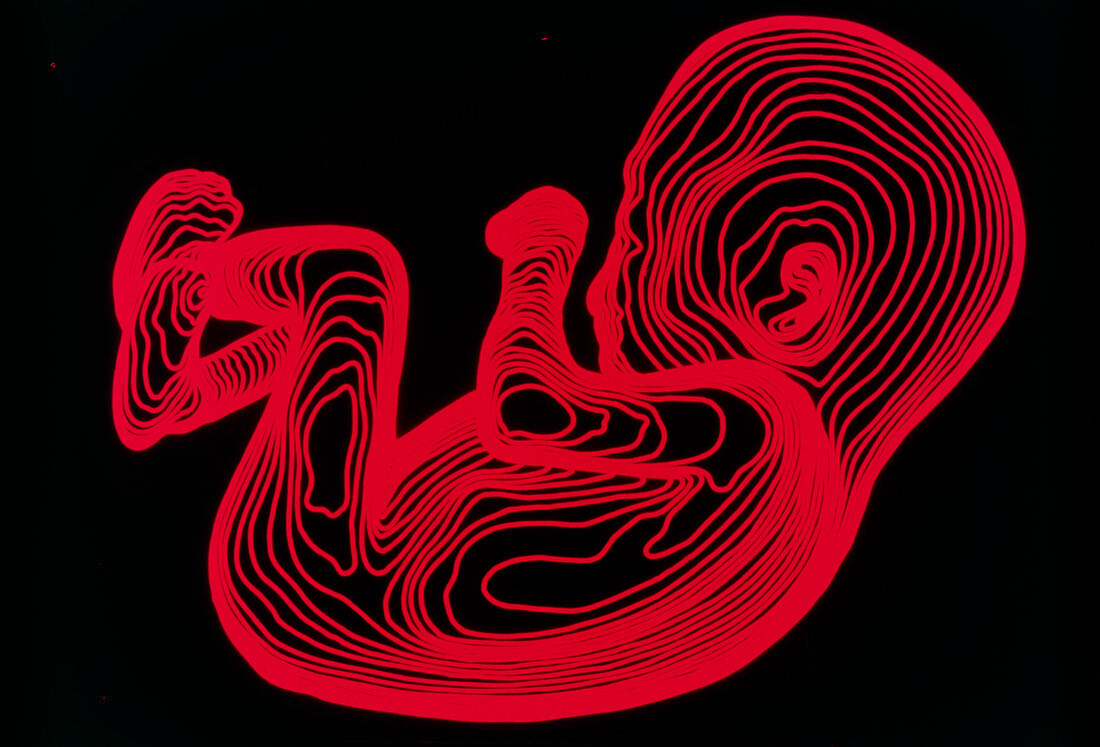 Body contour map of 14 week old foetus