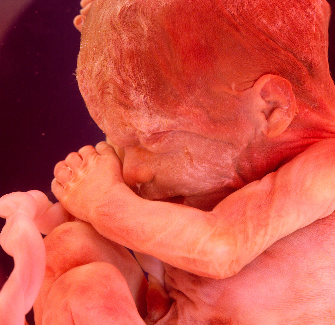 Human foetus at 12 to 15 weeks