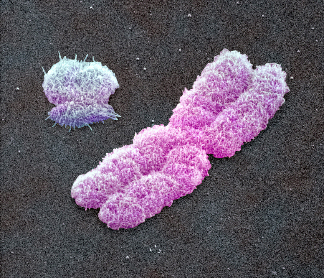 Male sex chromosomes,SEM