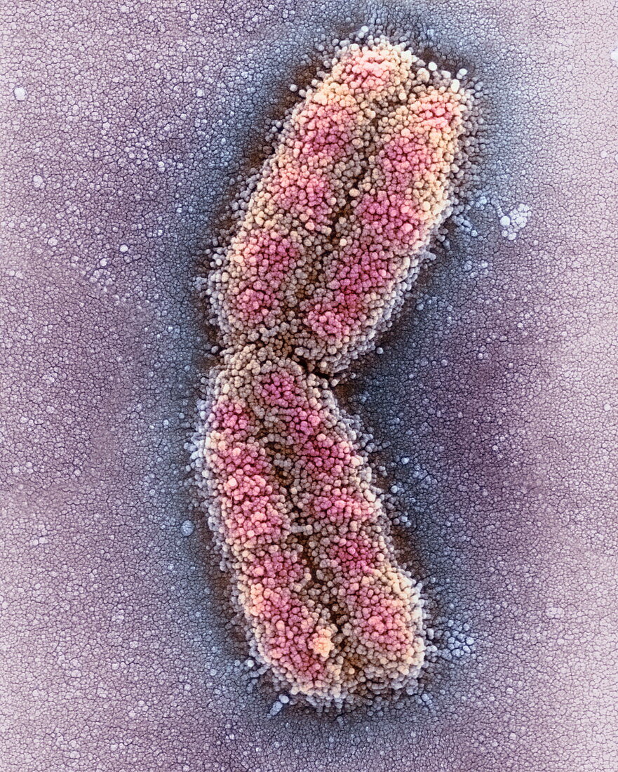 Human chromosome 1,SEM