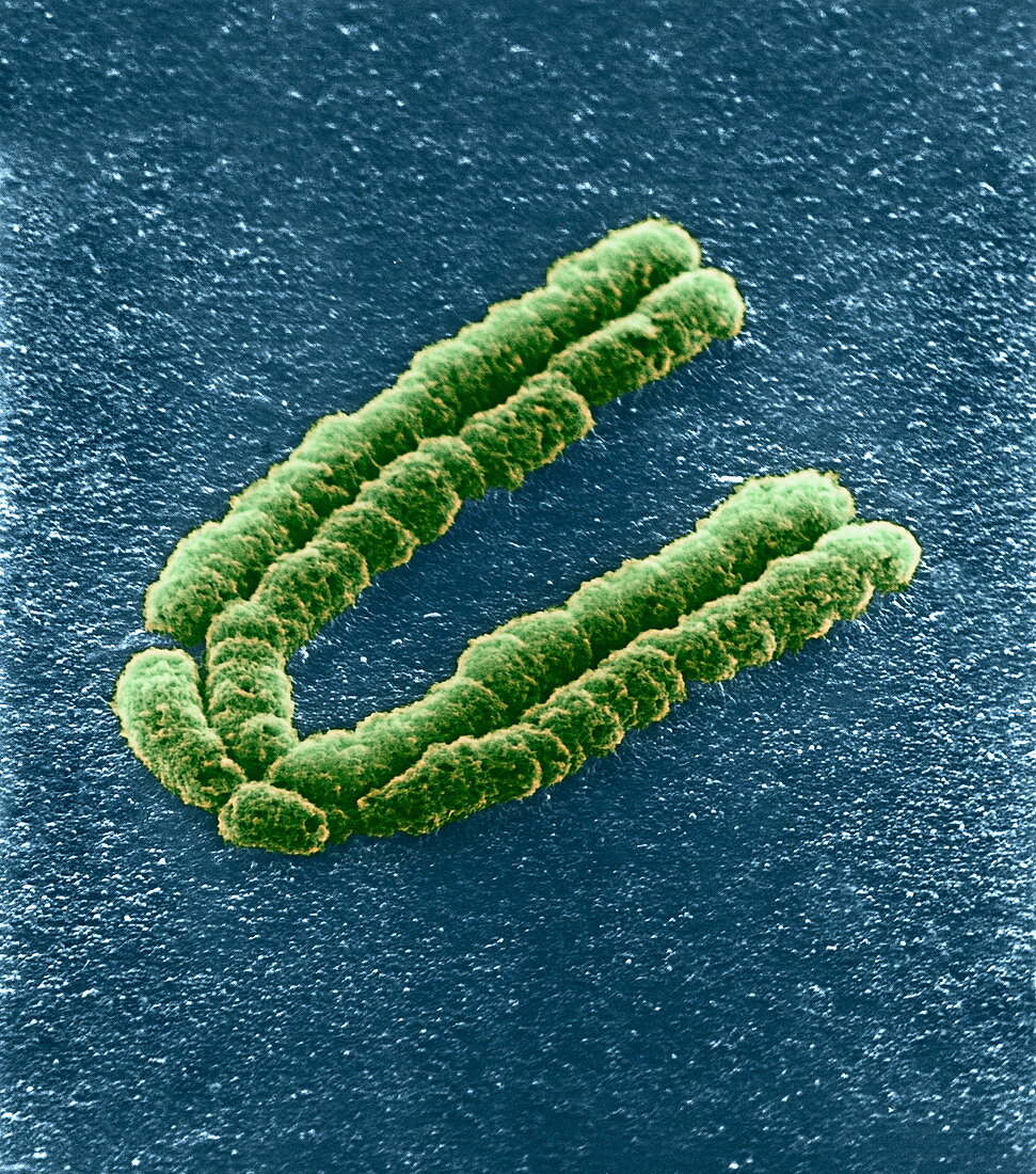 Chromosome,SEM