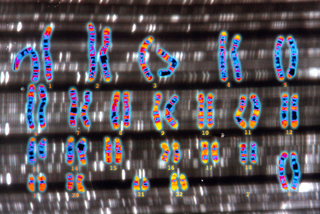 Human female karyotype and autoradiogram