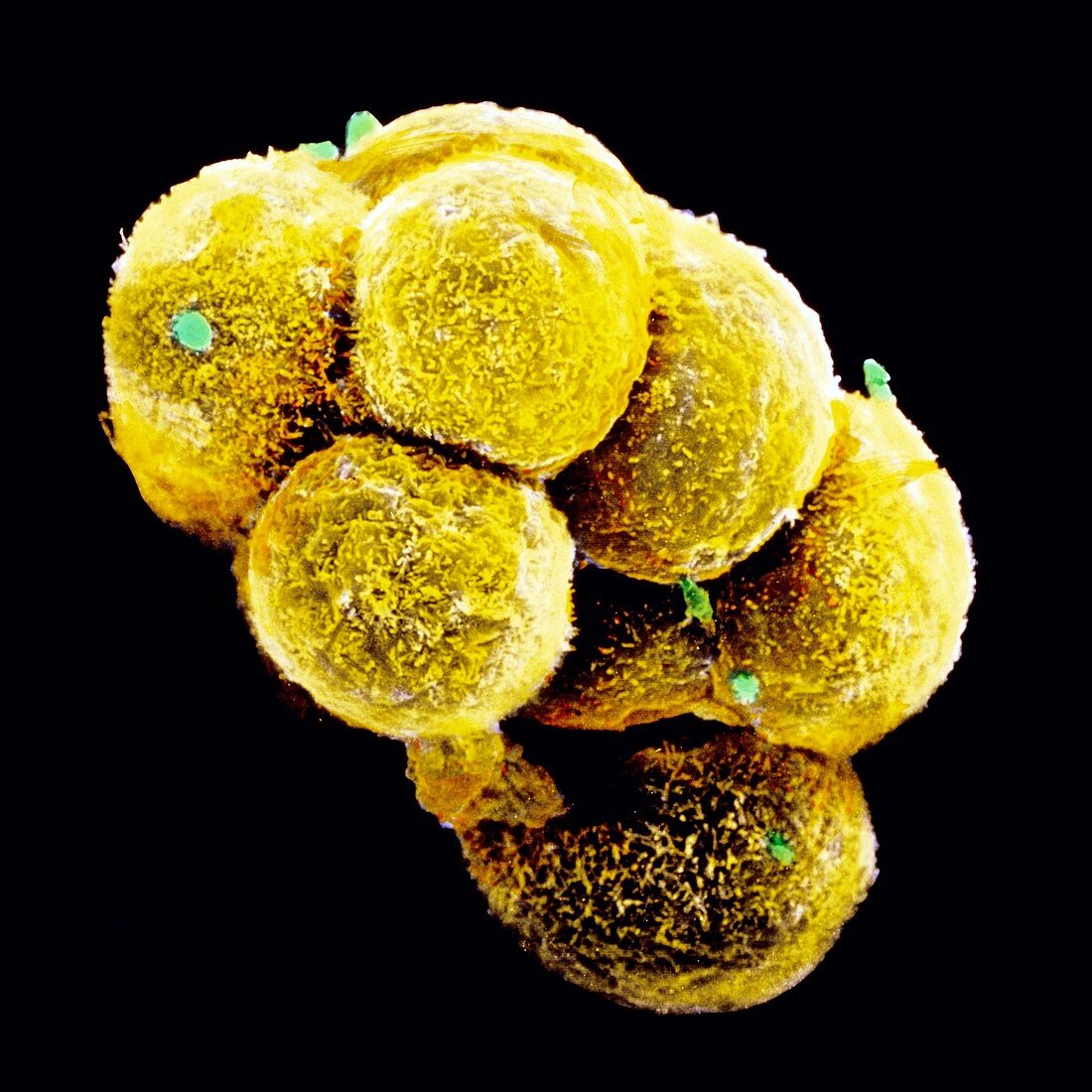 Coloured SEM of an embryo at the stage of morula