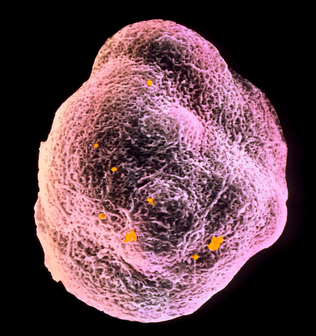 SEM of human embryo at 8-12 cell stage