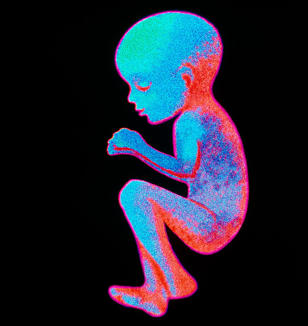 Computer graphic of a 15 week old human foetus