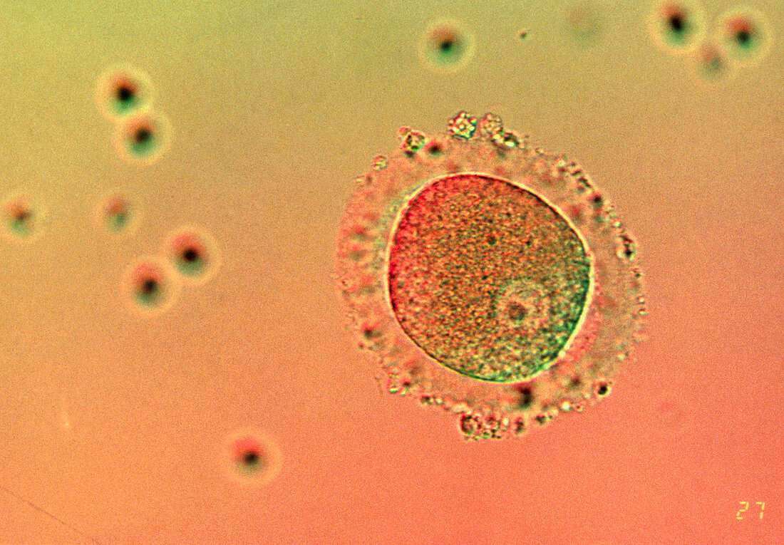 LM of human zygote after in-vitro fertilisation