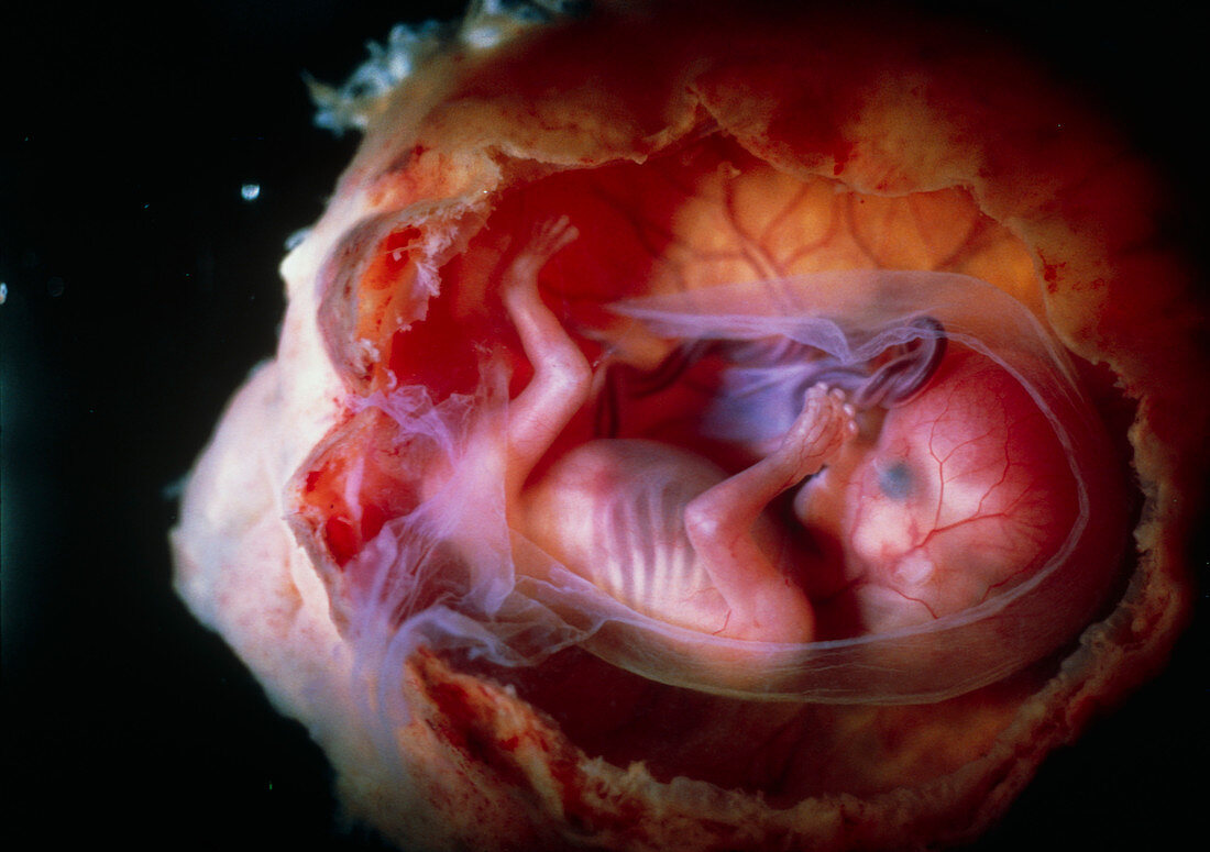 Human foetus at 4 months old (16 weeks)