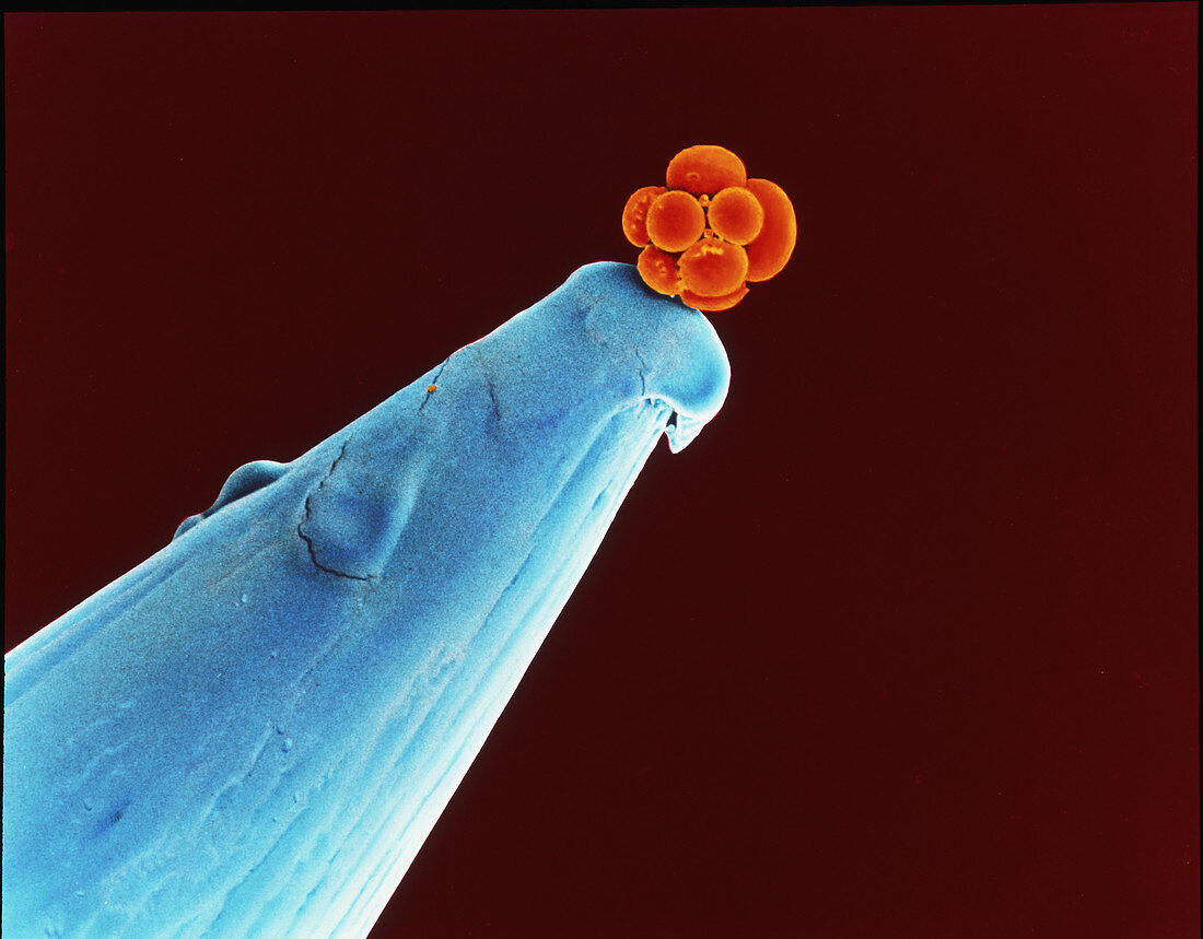 16-cell human embryo on a pin,SEM