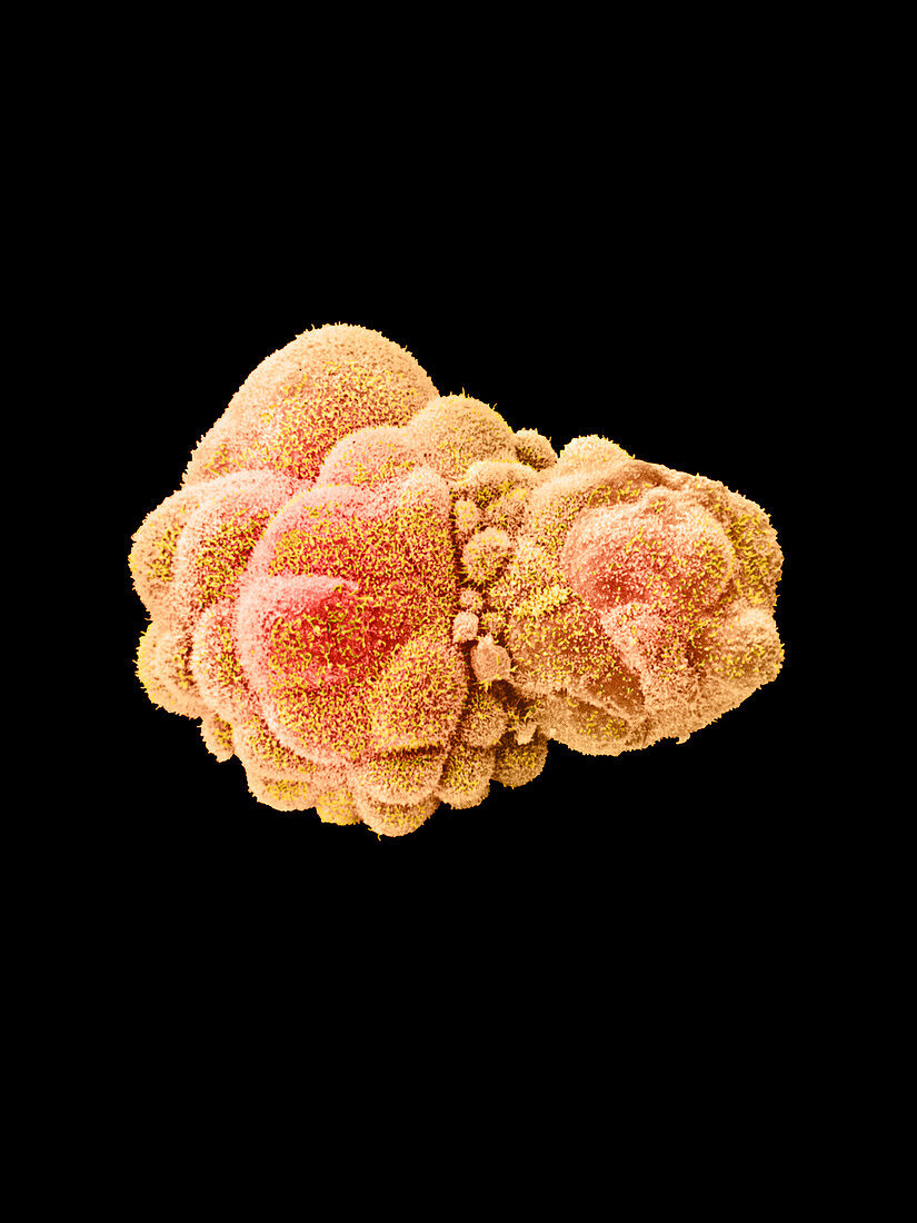 SEM of a hatched blastocyst 6 days old
