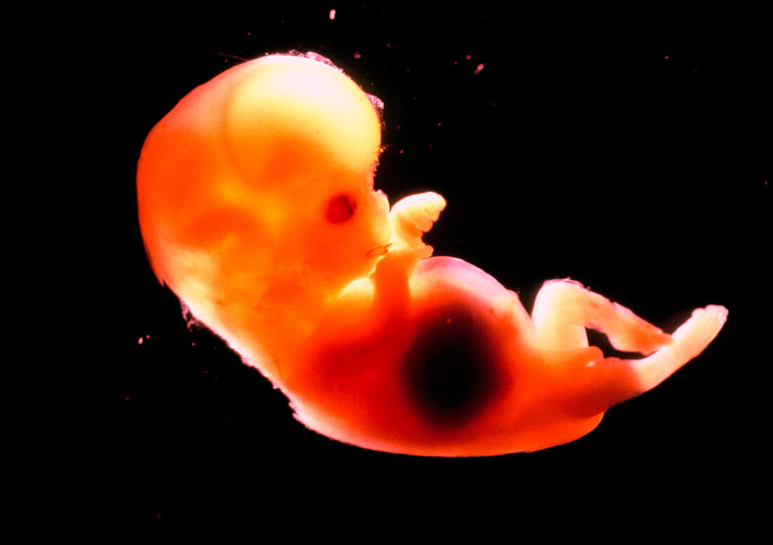 Side view of a 12 week old foetus