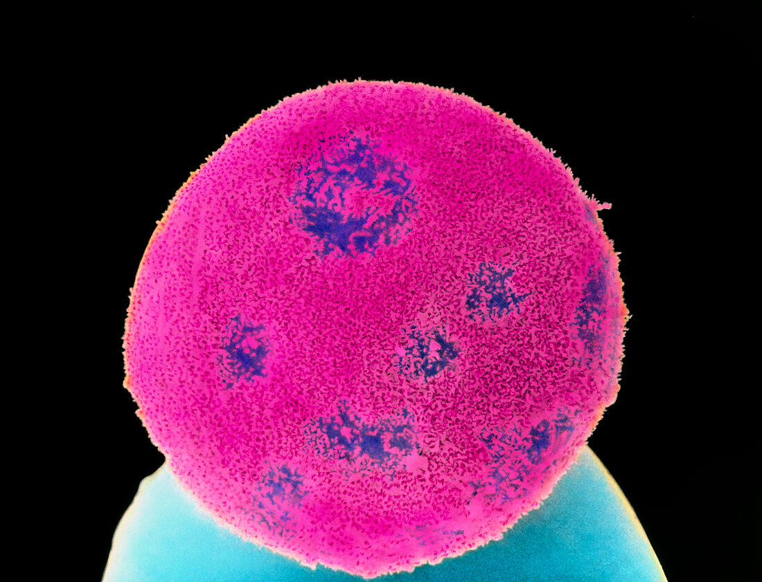 Coloured SEM of a blastocyst embryo 6 days old