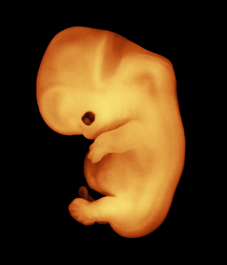 Human embryo 6 weeks old