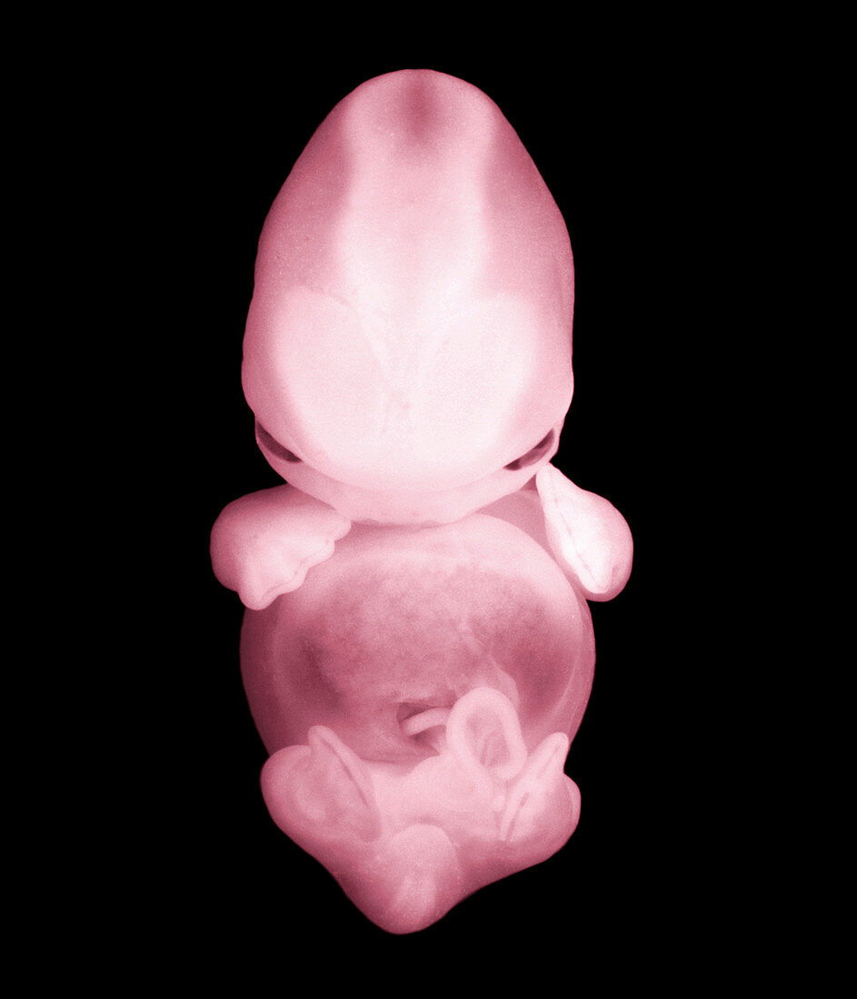 Coloured frontal view of a 44 day old human embryo