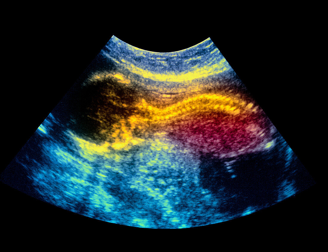16 week foetus ultrasound