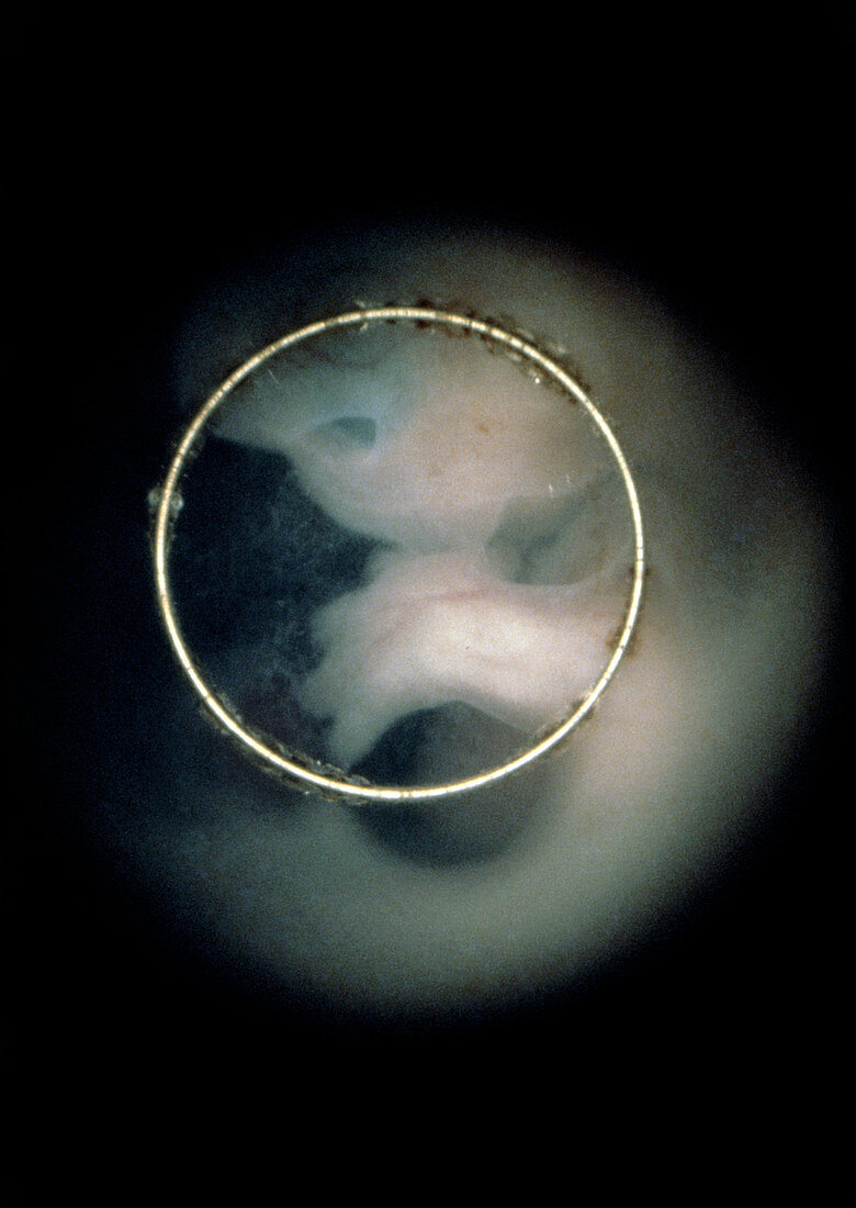 Human foetus showing hand