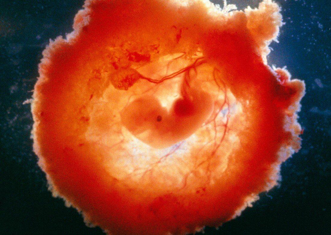 Human embryo at 7 weeks,suurounded by chorion