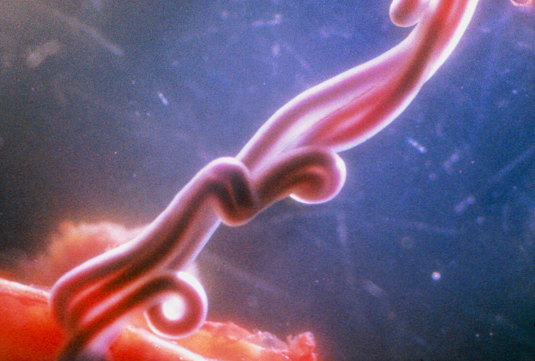 Umbilical cord of human foetus