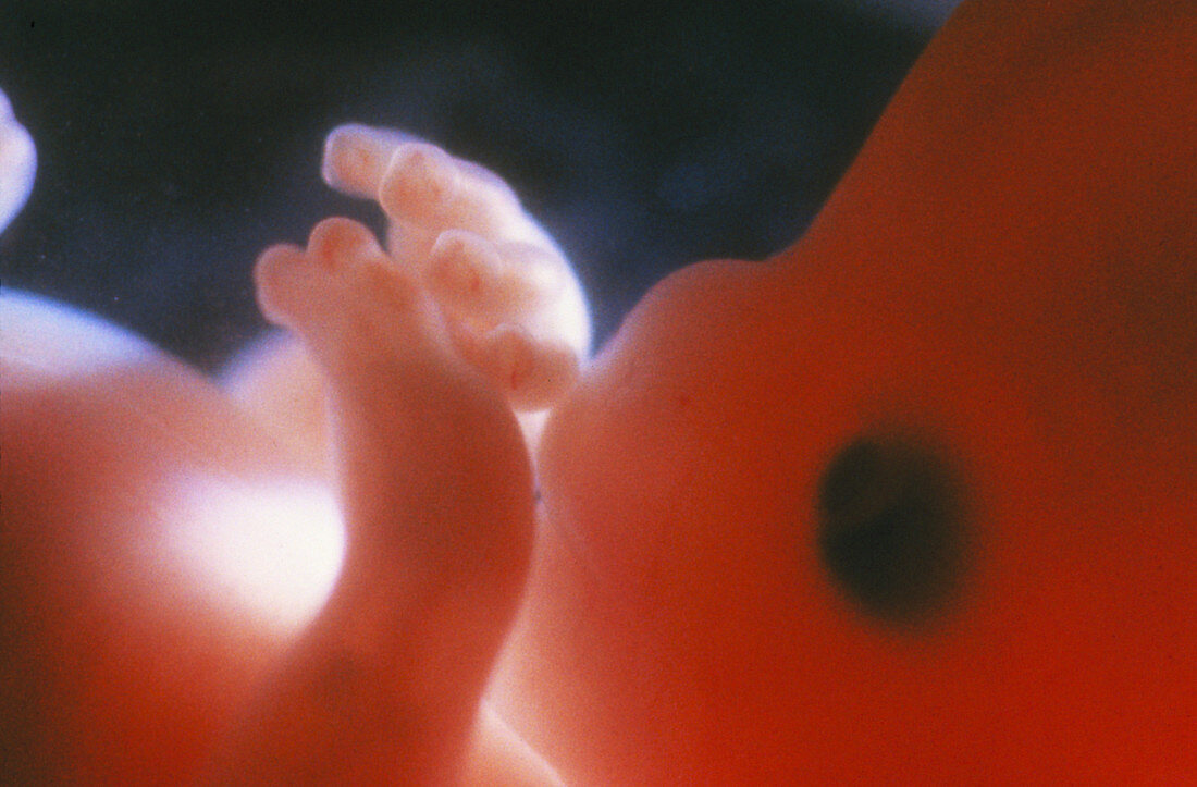 Foetus aged 10 weeks