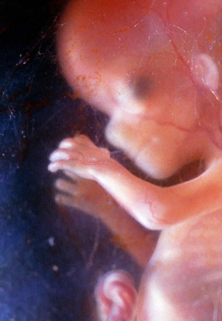 Foetus aged 14 weeks