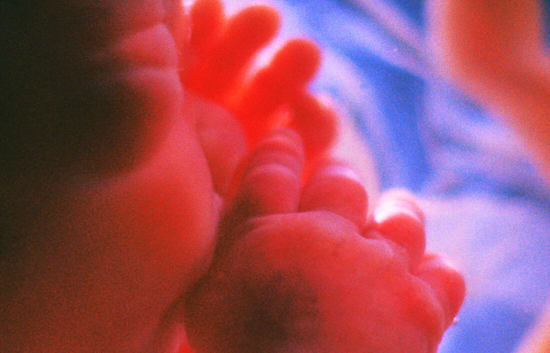 Foetus hands