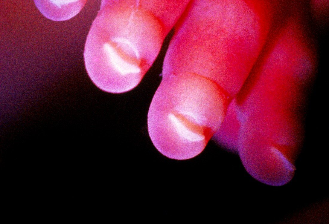 Fingers of a human foetus