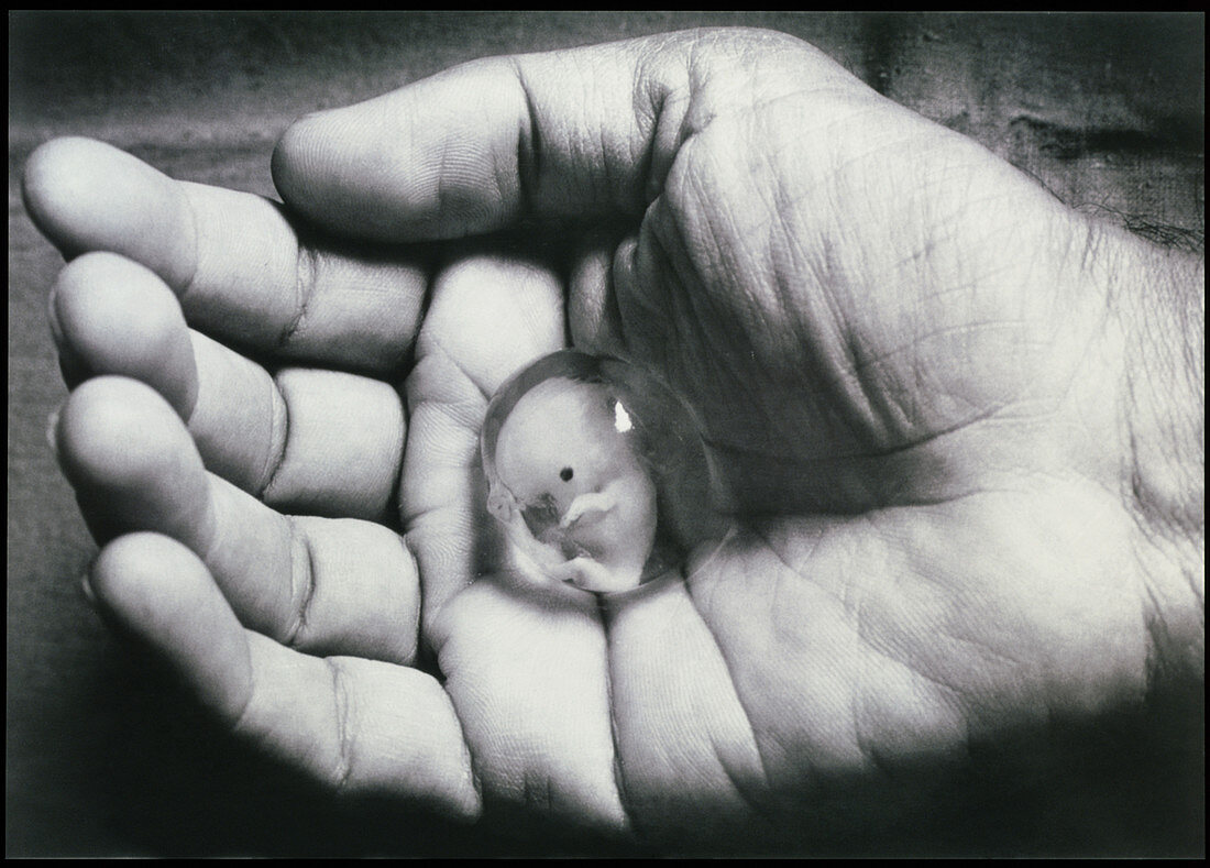 8 week human foetus in palm of hand