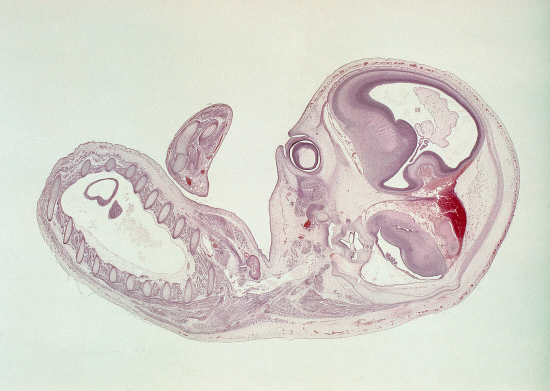 Light micrograph of a two month old foetus