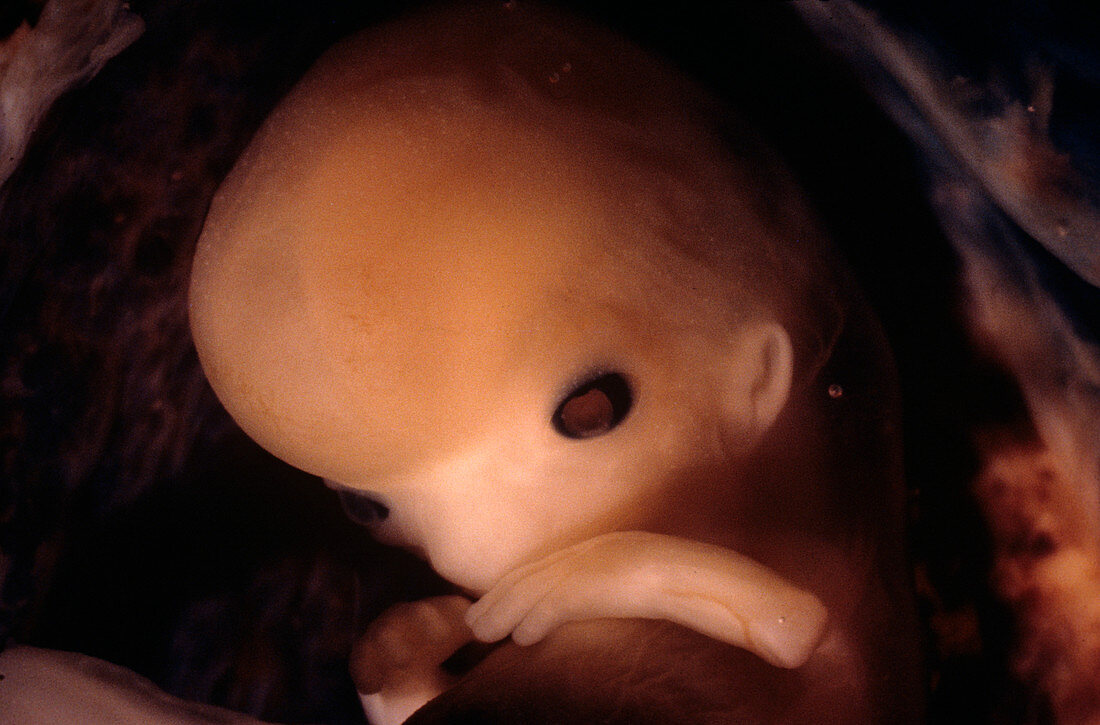 Foetus at 10 weeks