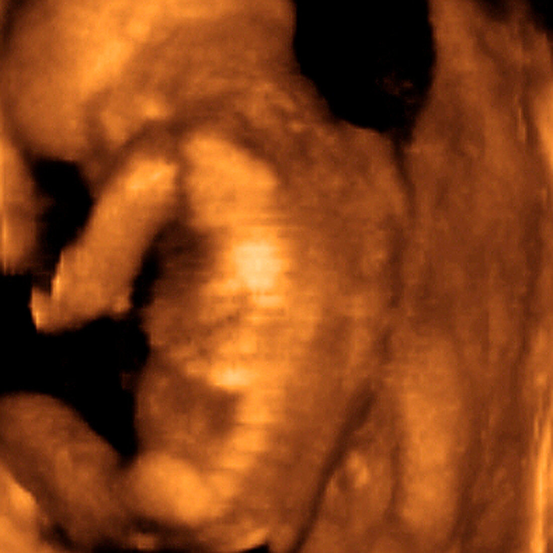 Foetus' back,3-D ultrasound scan