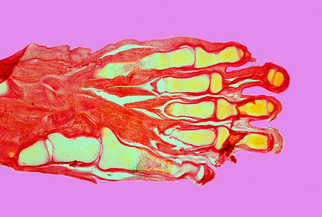 Human foetal hand,light micrograph