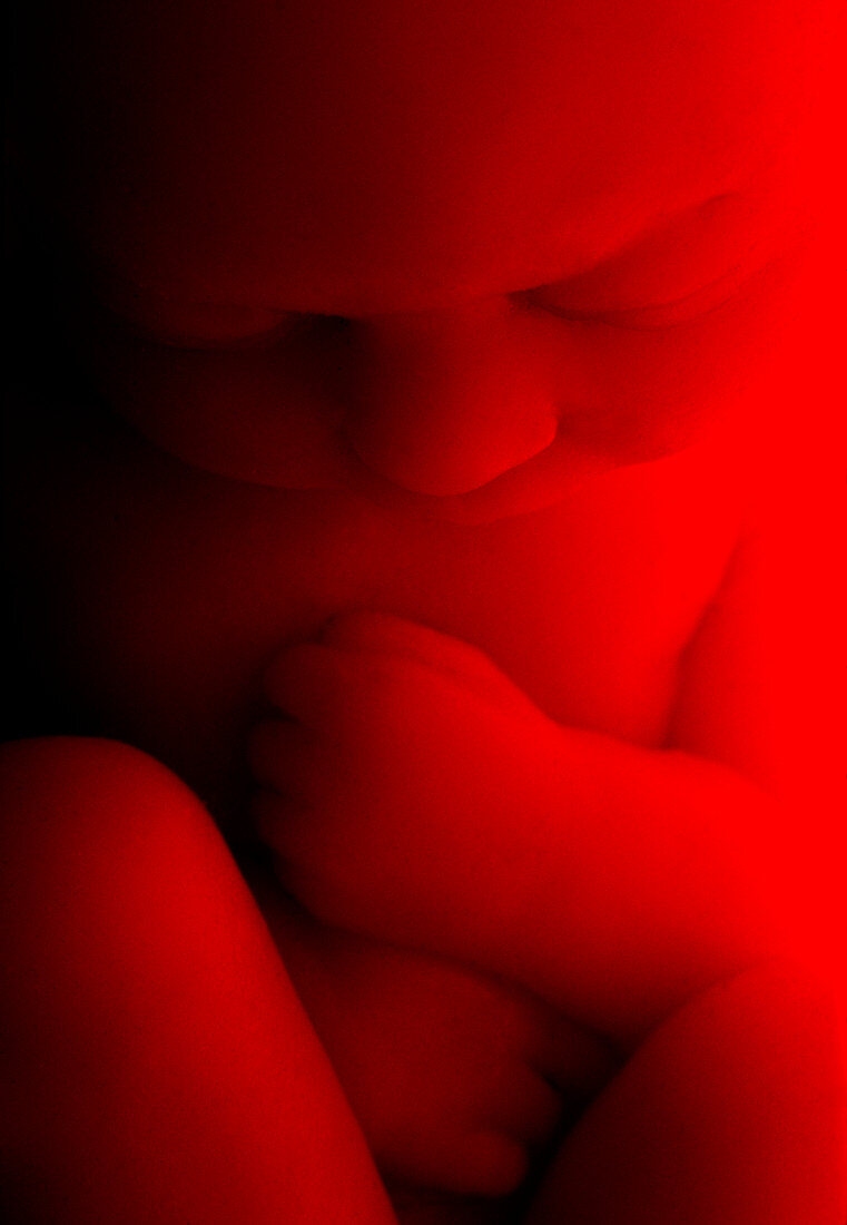 Foetus around 9 months old