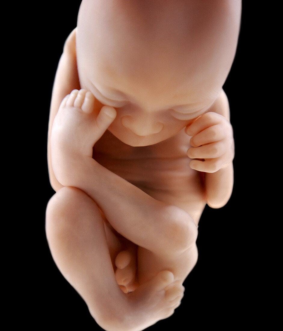 Foetus at 18 weeks