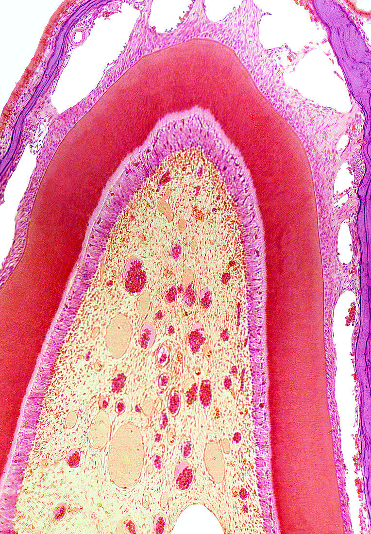 Foetal tooth,light micrograph