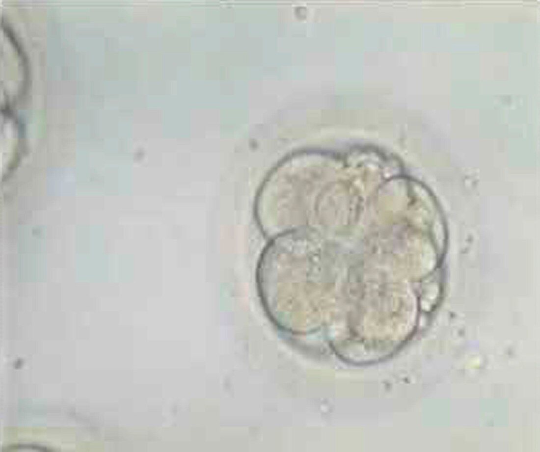 Multi-celled embryo,light micrograph