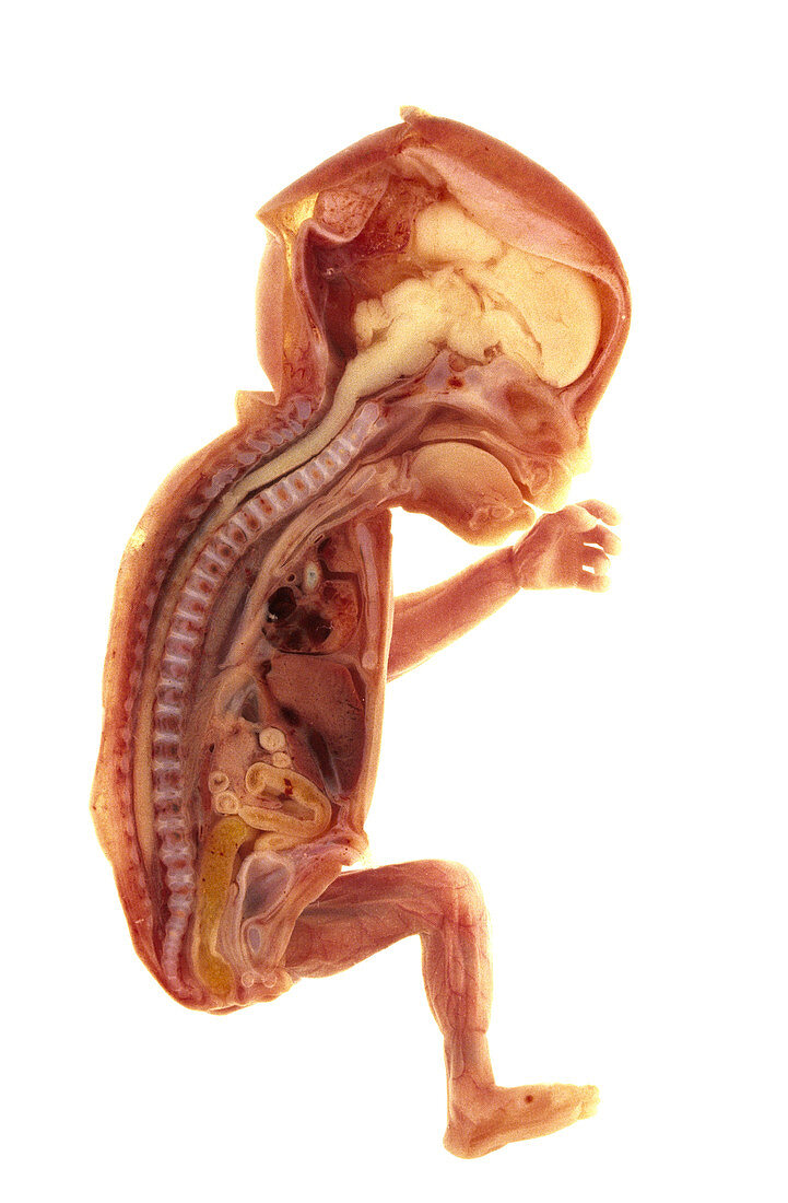 Sectioned foetus