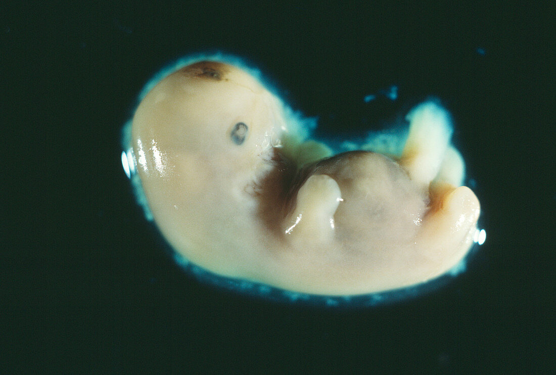Four-week-old embryo