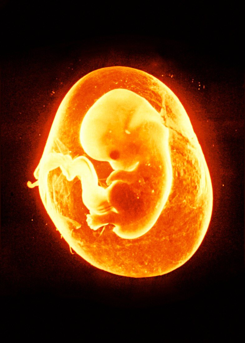 Eight-week-old foetus