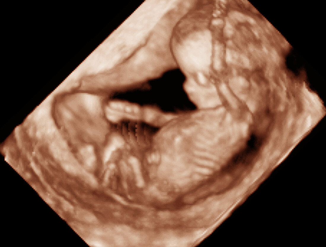 12 week foetus,3-D ultrasound scan