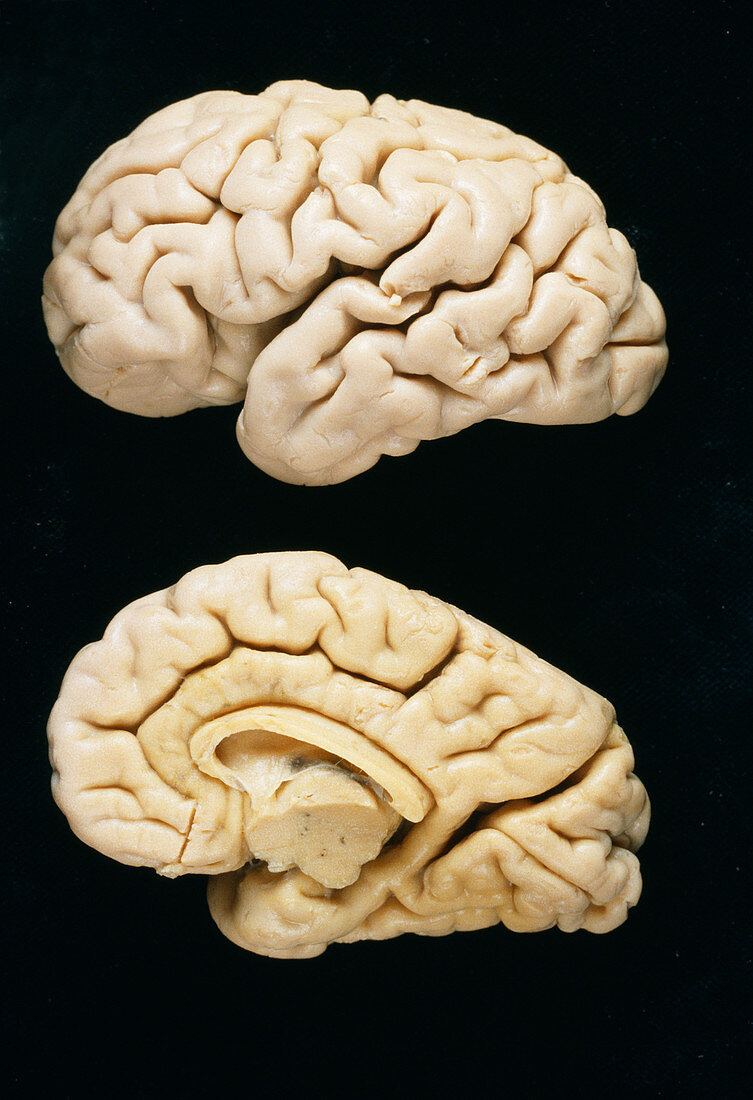 Neonatal brains