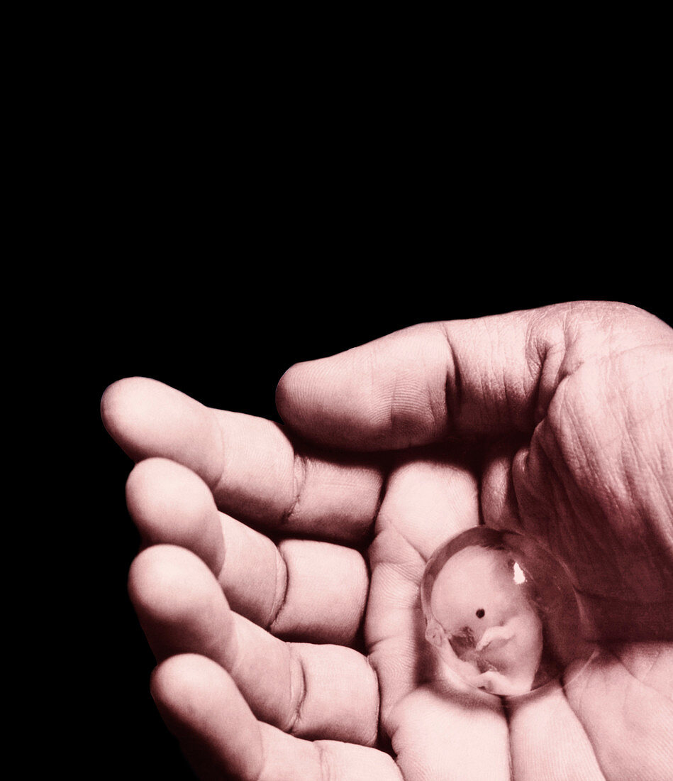 Hand holding foetus