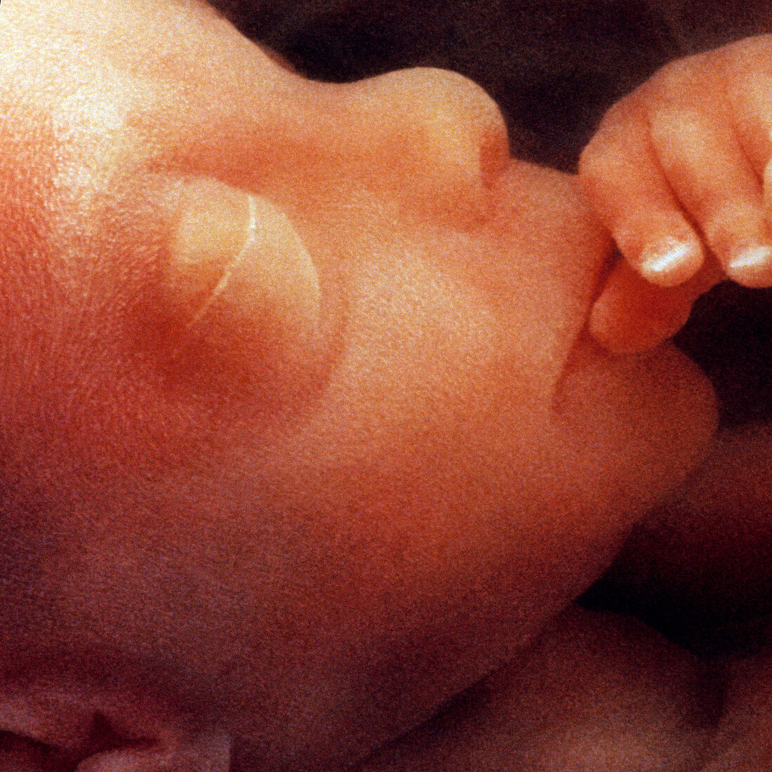 Foetus face aged 12 weeks