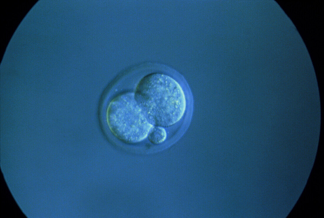 LM of a mouse embryo at the two-cell stage