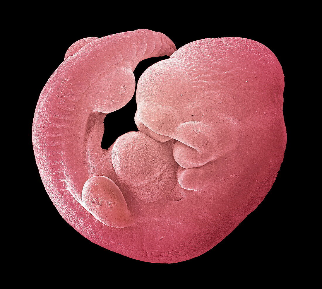Mouse foetus,SEM