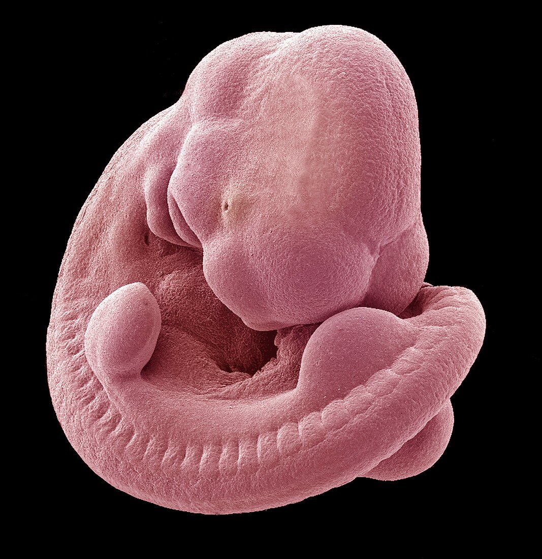 Mouse foetus,SEM