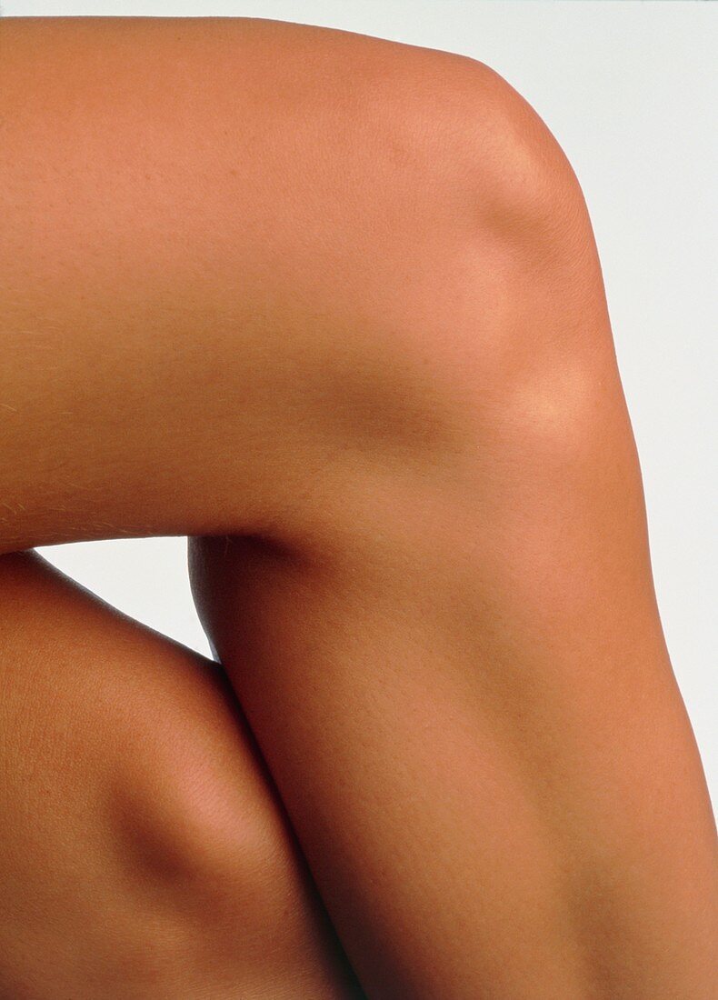 Side view of the knee of a woman